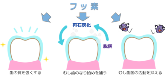 フッ化物使用によるむし歯予防効果を示すイラスト 歯の質の強化とむし歯のなり始めを補うことむし歯菌の活動を抑えることの3つ