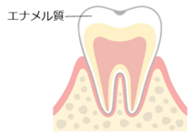 要観察歯の状態を示すイラスト